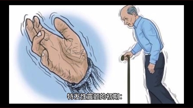 特发性震颤的初期症状