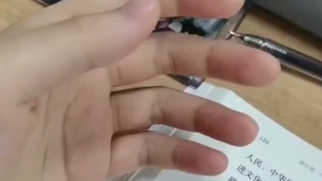 特发性震颤疾病就是特定情况下颤抖发病，特定情况就是以上说的这些症状都属于，很多人不把手抖当回事，这是