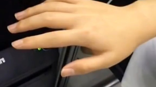 特发性震颤是一种运动障碍性疾病，患者头部、手部以及足部等其他部位会出现运动性震颤。该病会导致患者日常