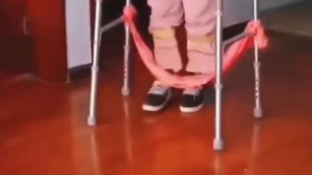 通常是手掌、指间的肌肉萎缩，虎口萎缩，慢慢地恶化到达肩膀、颈部、舌头、吞咽的肌肉萎缩，造成吞咽困难及