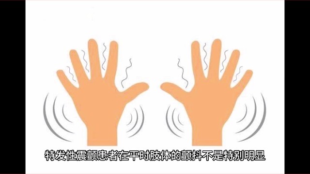 特发性震颤来临的前兆二