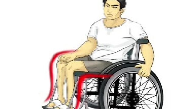 脊髓损伤恢复顺序是什么