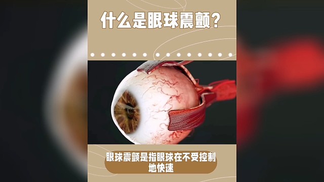 什么是眼球震颤？