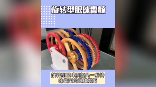 旋转型眼球震颤