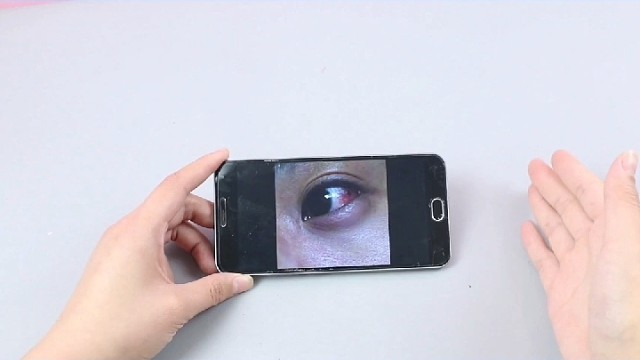 眼球震颤的表现眼球不由自主的转动