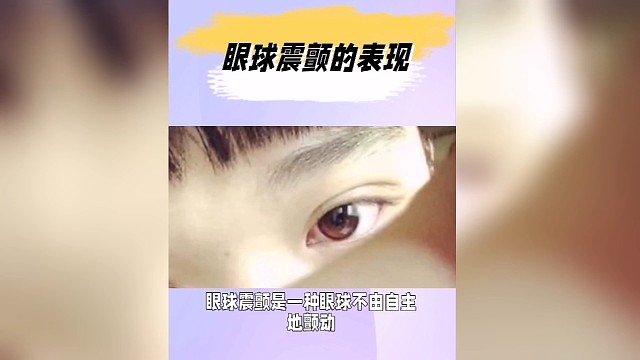 眼球震颤的表现