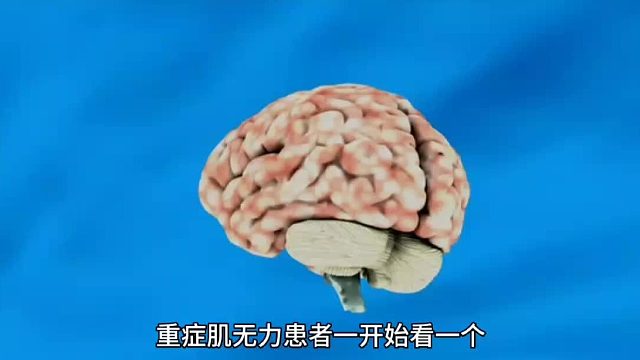 重症肌无力患者一开始看一个物体时很可能会出现复视的现象