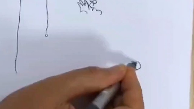 帕金森手抖不停，写字越写越小，你见过吗？