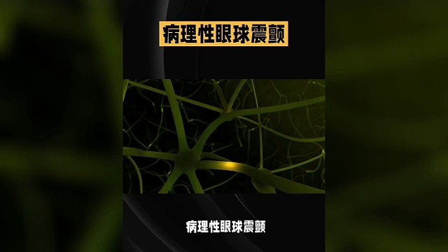 病理性眼球震颤