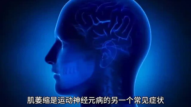 肌萎缩是运动神经元病的另一个常见症状