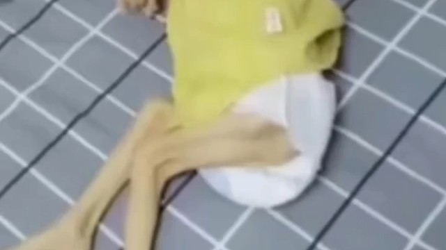 可是运动神经元的药物治疗也存在着各种各样的问题，而且药物治疗蜜月期一旦结束，运动神经元患者将不得不面