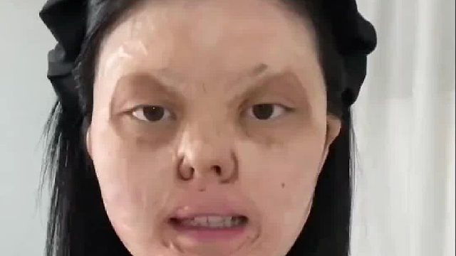 一岁半烧伤的女孩自信妆教，烧伤也是可以化妆的