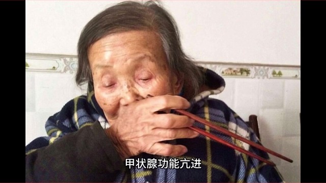 手抖会引起哪些疾病二