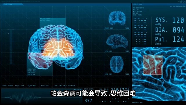 帕金森病会导致什么