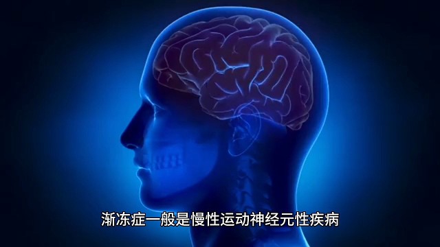 什么是漸凍癥？