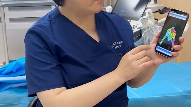 红外热CT是现代临床医学准确有效的补充检查手段