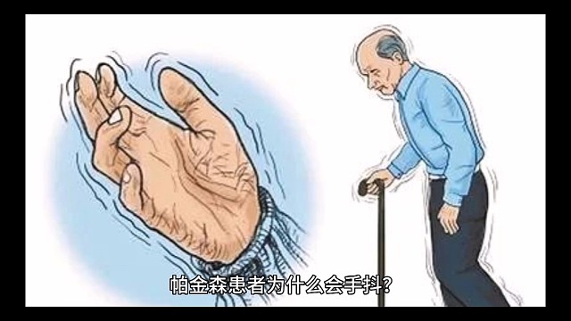 帕金森患者为什么会手抖？