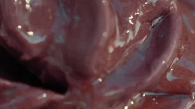 女子被确诊冰淇淋头痛一吃冰淇淋就头疼到无法上班