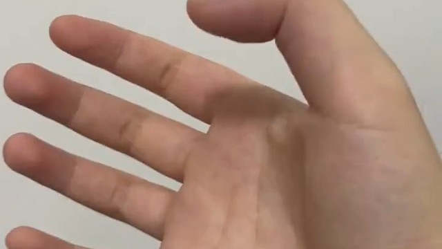 首先，要保持充足的睡眠，每天保证7-8小时的睡眠时间;其次，要进行适量的运动，增强身体代谢能力;同时