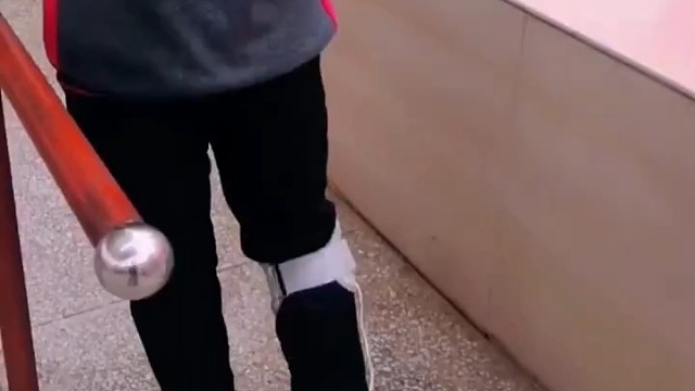 运动神经元病早期症状不是很明显，所以早期很多患者难以察觉，容易与其他的疾病相混淆，一般来说，运动神经