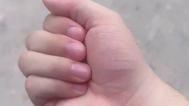 这东西见不得光，有阳光就跑