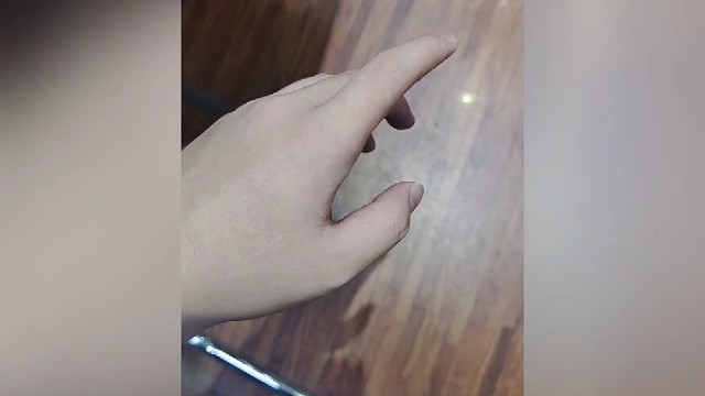 手抖症状，控制不住的震颤