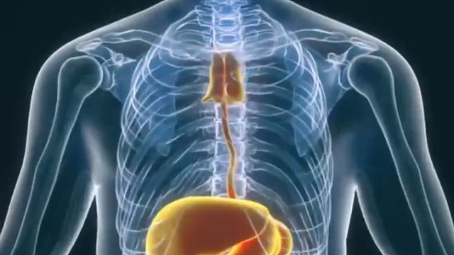 要注意预防#帕金森