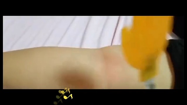 ③夜间症状：不宁腿综合症的症状通常在晚间和夜间出现或加重，会影响患者入睡和睡眠质量，导致白天疲劳、嗜