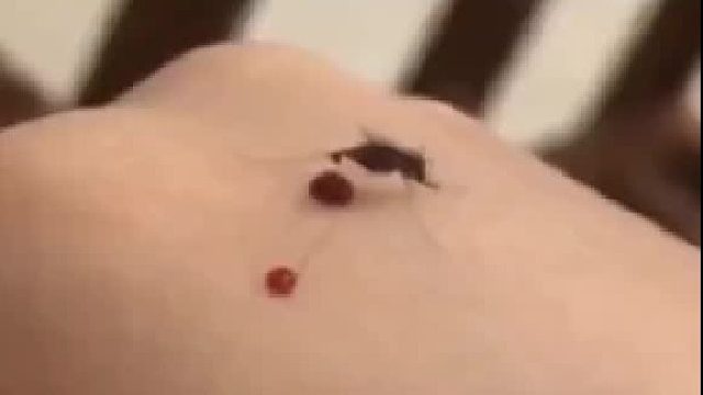 蚊子：惨了，这人吃添加剂太多，害得我当场拉稀