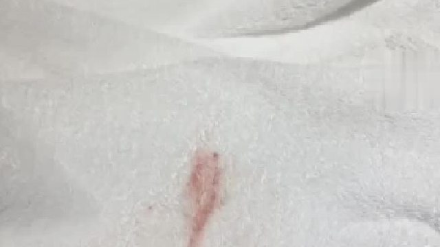 某酒店回应“女子用酒店毛巾擦完发现不明血迹”：无法确定血迹从何而来，警方现在正在协商，对方不满意