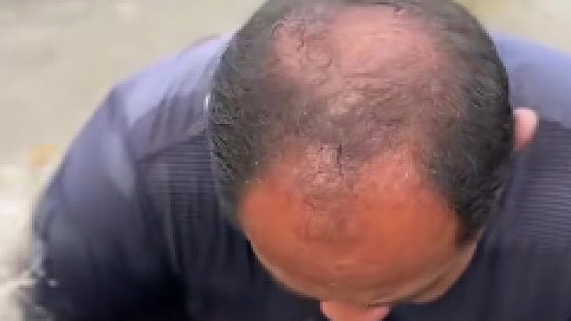 鱼嘴巴里藏了这么多鱼崽