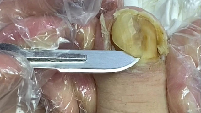 为什么不彻底禁烟呢？