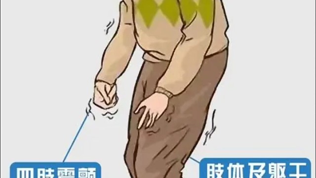 简单了解一下帕金森吧