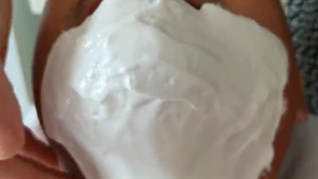 下面有请毛囊发炎[灵光一闪]