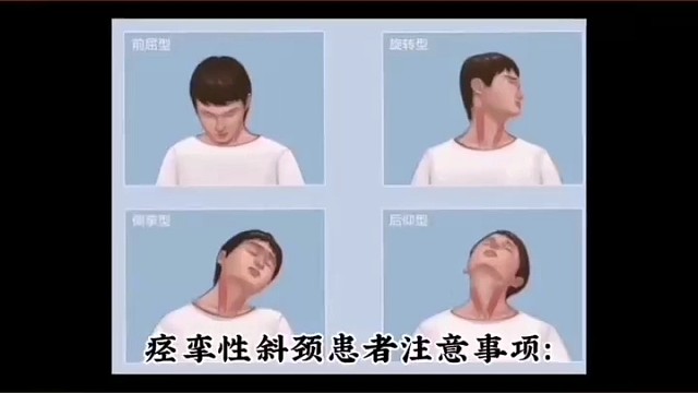 注意事项#痉挛性斜颈
