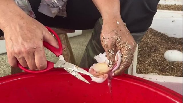 这个算刨腹产？