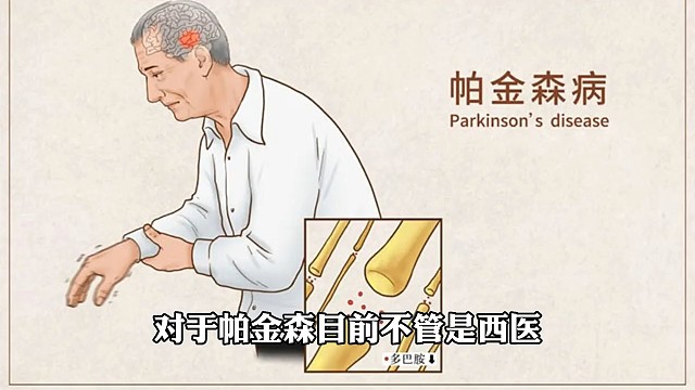 对于帕金森中药还是有一定的优势