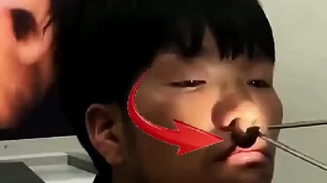 这就是鼻涕虫吗