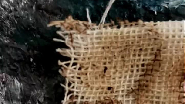 伤疤就是伤疤，不需要被美化成勋章