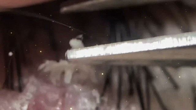 微观镜头下的头皮屑