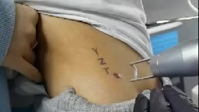 纹身一时爽洗纹身更爽