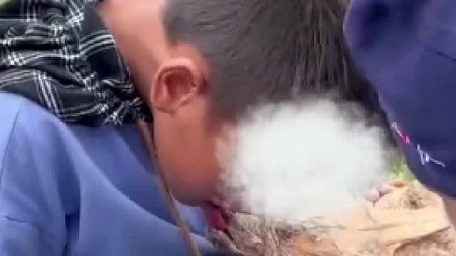 男孩嘴唇被乌龟紧咬不放医生使出小妙招解救