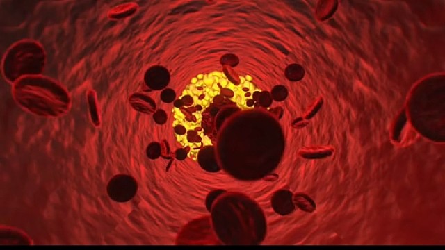 特发性震颤要重视！！！