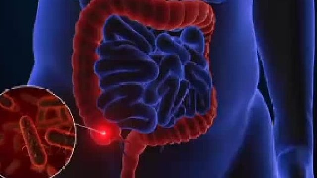 脑鸣发生与这些有关