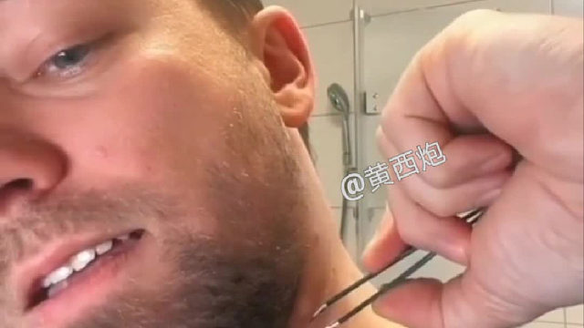 一根超长的、向体内生长的毛发……