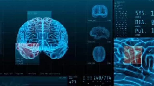 脑鸣不是独立疾病