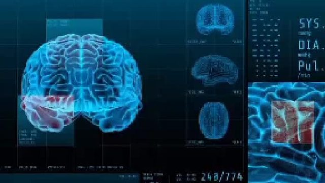 脑鸣功能性疾病