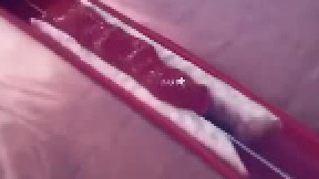 好好爱惜自己的血管