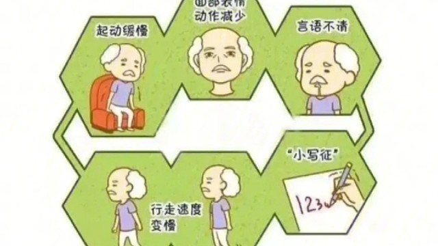 帕金森的典型症状