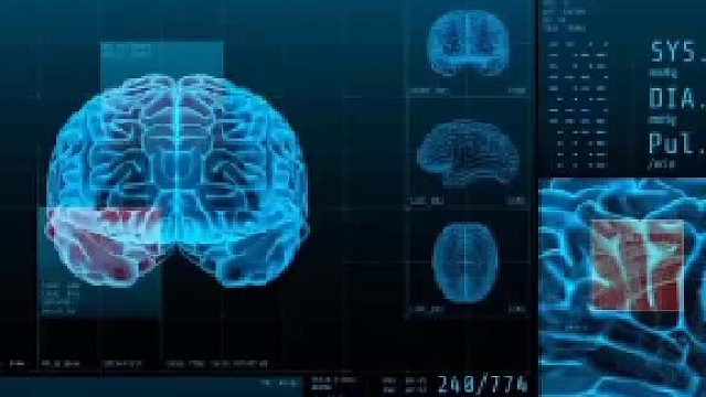 脑鸣发作的症状